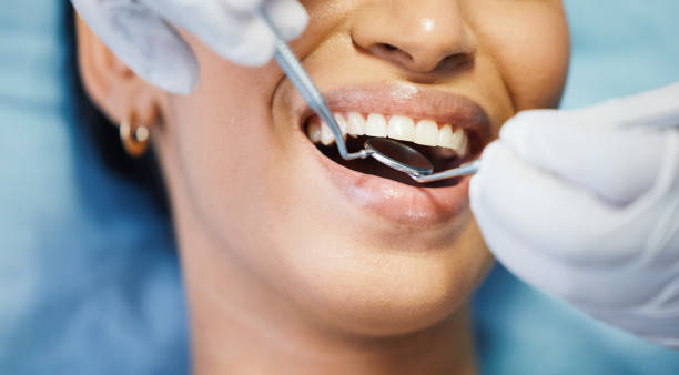 Best Mobile Emergency Dentist in Rancho Laveras, CA
