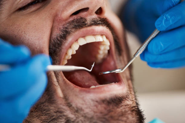Best Orthodontic Emergency Dentist in Rancho Laveras, CA