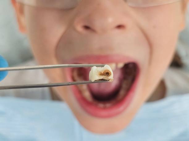 Best Emergency Dental Services for Seniors in Rancho Laveras, CA