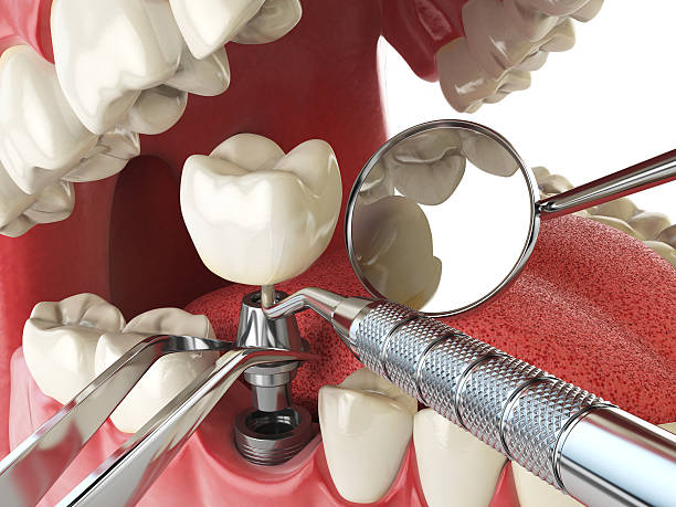 Best Orthodontic Emergency Dentist in Rancho Laveras, CA